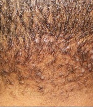 AKN Service - Dr U Hair And Skin Clinic