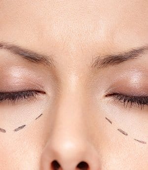 Dr U Skin Services - Dr U Hair And Skin Clinic