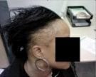 To avoid hair loss women should learn about traction alopecia prevention and treatment To avoid hair loss women should learn about traction alopecia prevention and treatment