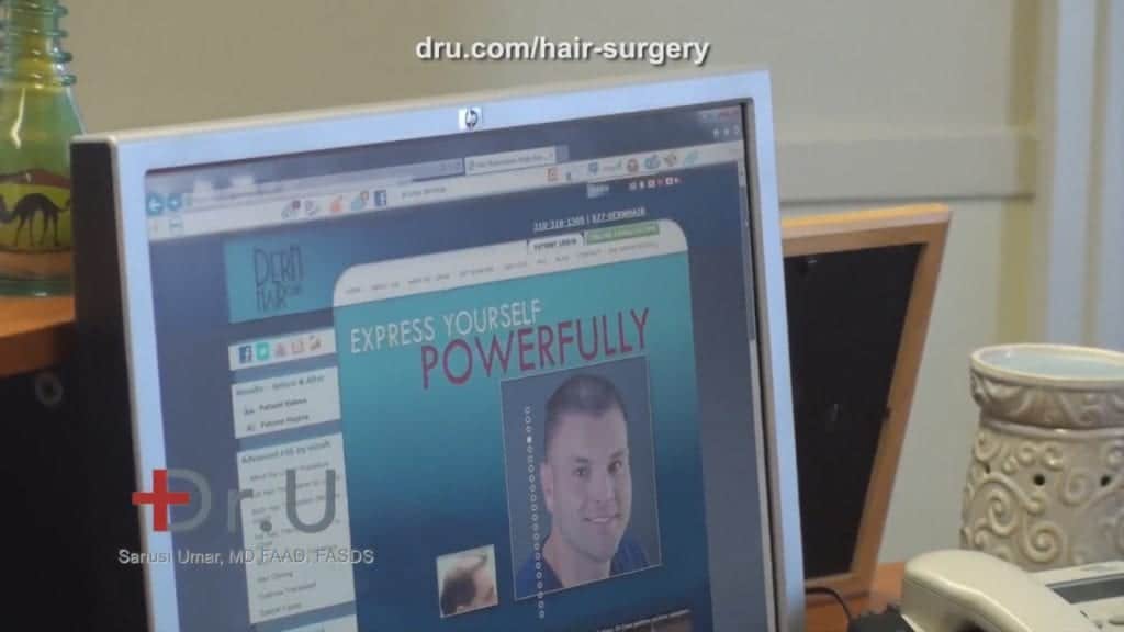 Understanding Hair Transplant Surgery Through Research Understanding Hair Transplant Surgery Through Research