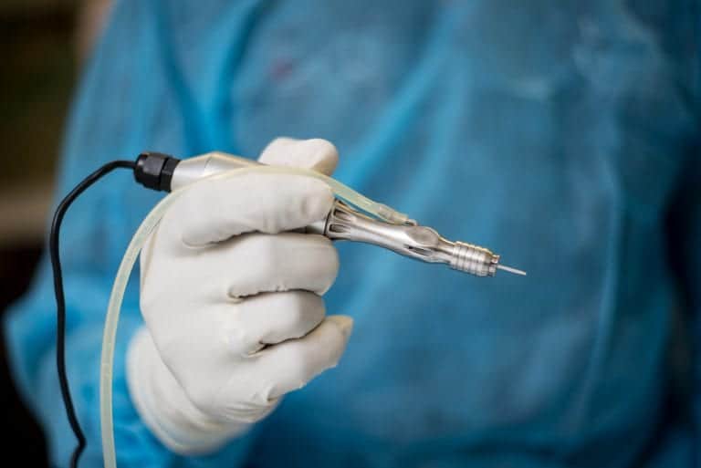 The Dr.UGraft Rotor™ is one of the devices of Dr.UGraft™ set of advanced FUE technologies. It's specialized features make it possible to select more natural caliber donor hairs from the nape and other areas of the body to help patients achieve thick shaped eyebrows that are natural looking in appearance. The Dr.UGraft Rotor™ is one of the devices of Dr.UGraft™ set of advanced FUE technologies. It's specialized features make it possible to select more natural caliber donor hairs from the nape and other areas of the body for eyebrow hair restoration surgery.