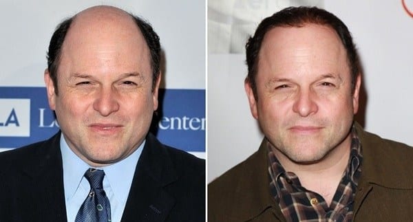 Celebrity Jason Alexander attempts the toupee look. Celebrity Jason Alexander attempts the toupee look.