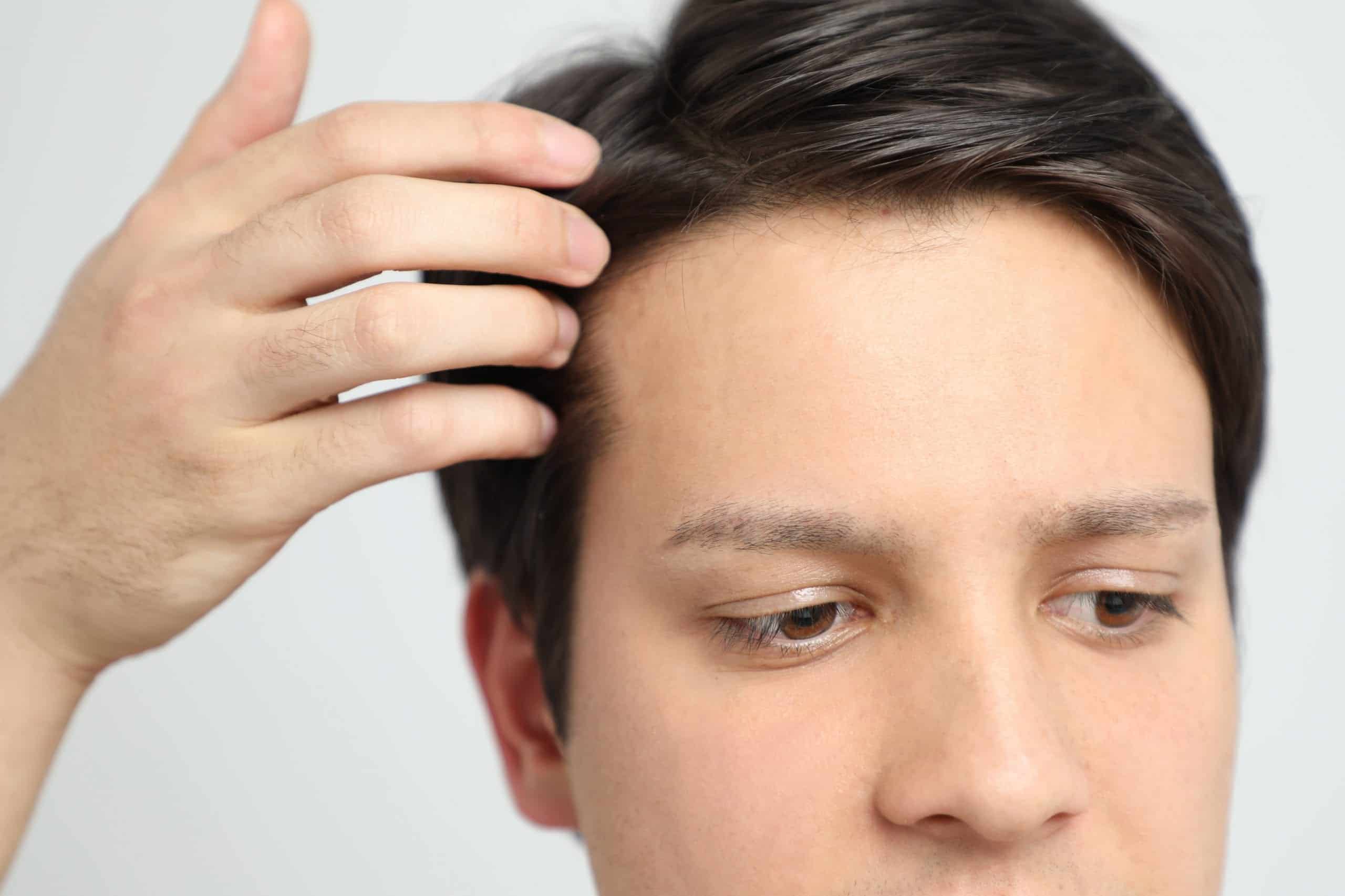 A male hairpiece may or may not look convincing A male hairpiece may look convincing. But it's difficult to know when socially awkward clues and dead-giveaways may arise