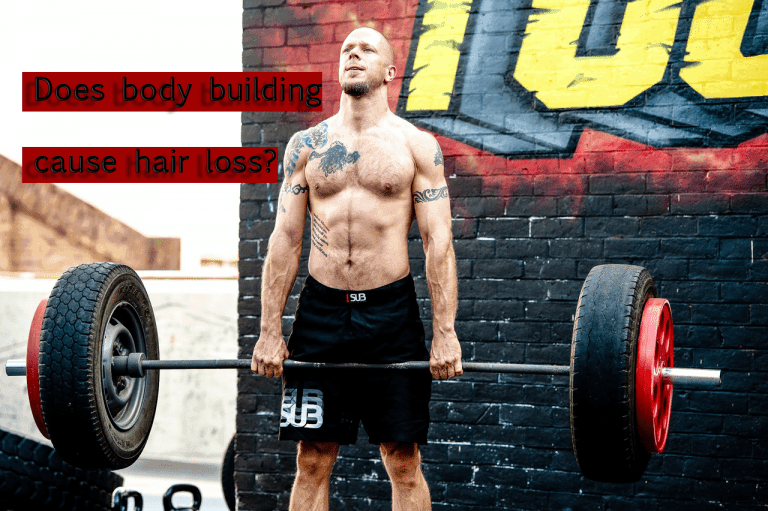Many people often note that body builders tend to be bald or balding. This prompts many to wonder if there is a connection between testosterone and hair loss.