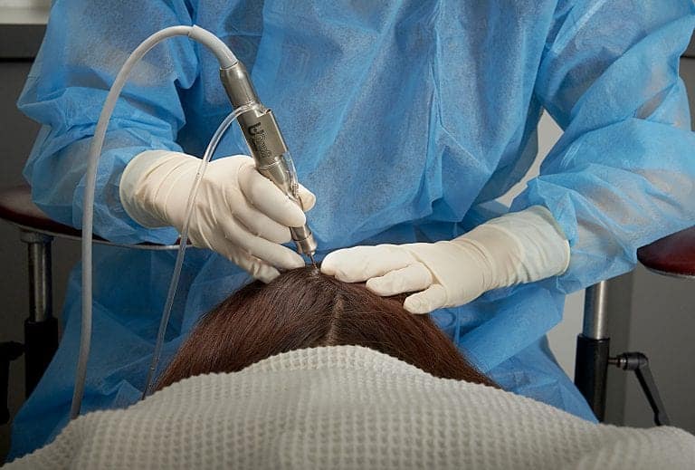 Dr.UGraft™ is the first-ever all-in-one system able to extract hair of all textures from all parts of the body. This includes the nape area, chest area, scalp area, and pubic area. Dr.UGraft™ is the first-ever all-in-one system able to extract hair of all textures from all parts of the body. This includes the nape area, chest area, scalp area, and pubic area.