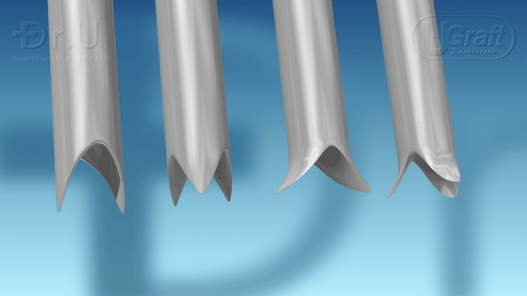 Different types of FUE hair transplant tools can be used for different types of patients. Different types of FUE hair transplant tools can be used for different types of patients.