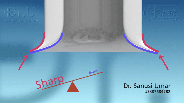 This hybrid FUE punch tip tends more to the sharper end of the continuum. This hybrid FUE punch tip tends more to the sharper end of the continuum.
