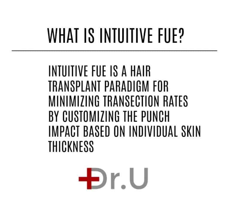 Intuitive FUE offers a new and unprecedented approach for minimizing hair transplant graft transection rates. Intuitive FUE offers a new and unprecedented approach for minimizing hair transplant graft transection rates.