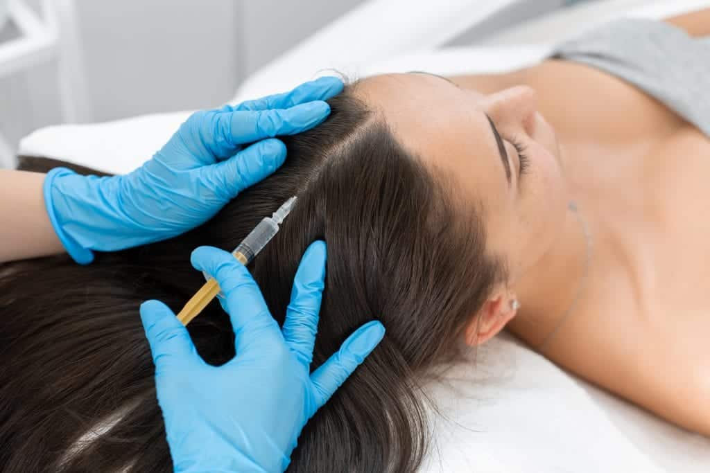 Stromal Vascular Fraction SVF is delivered to target areas like the scalp by direct injections Stromal Vascular Fraction SVF is delivered to target areas like the scalp by direct injections