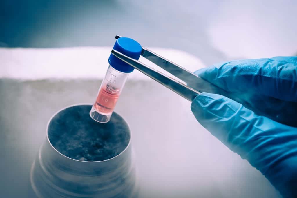 stromal vascular fraction SVF stromal vascular fraction SVF