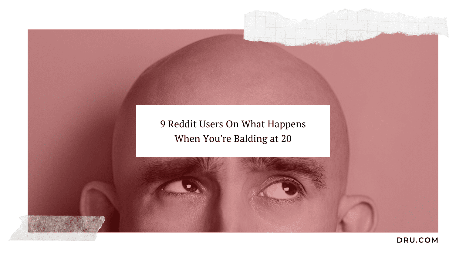 9 Reddit Users on Balding At 20 Shared Experiences
