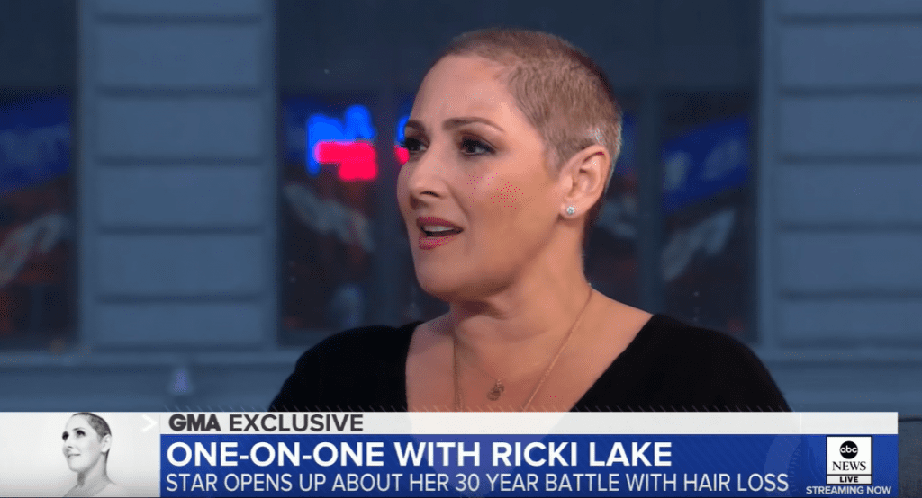 Ricki Lake discusses her hair loss on Good Morning America celebrity hair loss
