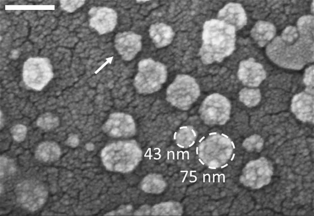 Electron microscope photos of exosomes