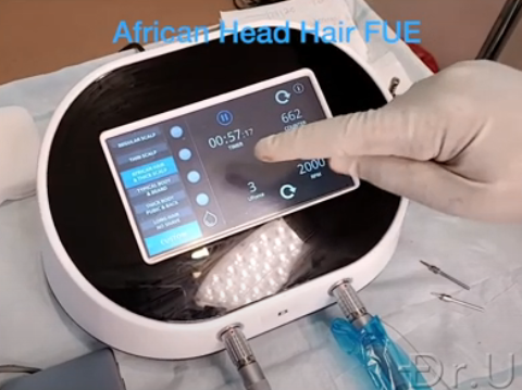 The Dr.UGraft Zeus console offers a touch-screen interface and presets based on skin thickness types across all ethnic groups The Dr.UGraft Zeus console offers a touch-screen interface and presets based on skin thickness types across all ethnic groups